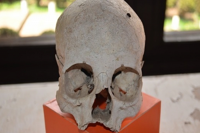 В Иркутске обнаружена свалка человеческих останков